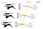 Intelect Focus Shockwave - Spina Calcaneare Epicondilite Tendinite Calcifica Tendinite Achillea Fascite Plantare Sindrome del Tibiale ...