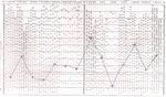 CRS-R Conners' Rating Scales - Revised - EPG - IL DISAGIO EVOLUTIVO NEI CONTESTI FAMILIARE E SCOLASTICO - Dipartimento di ...