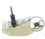 Istruzioni per l'uso del sistema C-Guide e delle frese Densah