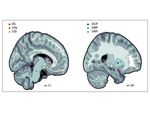 Neurobiologia dell'ADHD: modelli interpretativi e strategie operative Adriana Di Martino