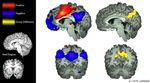Neurobiologia dell'ADHD: modelli interpretativi e strategie operative Adriana Di Martino