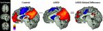 Neurobiologia dell'ADHD: modelli interpretativi e strategie operative Adriana Di Martino