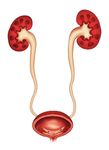 Il trattamento minimamente invasivo per il reflusso vescico-ureterale (RVU)