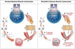 Dieta chetogenica per Glicogenosi tipo 5 - Trial multicentrico randomizzato Work in progress! - Associazione Italiana ...