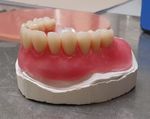 Linea dedicata alla Termoformatura - Pressing dental