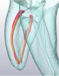 Corso di Perfezionamento Teorico-Pratico in Endodonzia 2018 - Direttore: Prof. Sandro Rengo - Ordine Medici Napoli