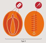VIOLENZA DI GENERE NEI CONFRONTI DI DONNE RIFUGIATE E RICHIEDENTI ASILO - Manuale formativo del Progetto CCM-GBV - Heuni
