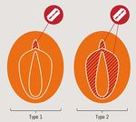 VIOLENZA DI GENERE NEI CONFRONTI DI DONNE RIFUGIATE E RICHIEDENTI ASILO - Manuale formativo del Progetto CCM-GBV - Heuni