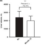 Expert Opinion della Società Italiana di Endocrinologia sull'utilizzo di metreleptina (Myalepta) nei pazienti con lipodistrofia parziale