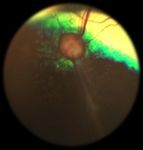 Oculopatie Ereditarie in Italia nel Pinscher e nello Schnauzer