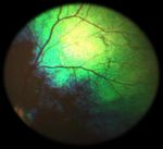 Oculopatie Ereditarie in Italia nel Pinscher e nello Schnauzer
