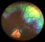 Oculopatie Ereditarie in Italia nel Pinscher e nello Schnauzer