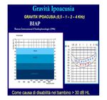 IL PEDIATRA E LE IPOACUSIE - DOTT. LUCIA RUGGIERI - ASL RMF - FIMP Lazio