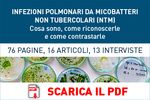 Pneumologie italiane, il 94% in prima linea nella lotta contro l'infezione da Covid-19 - AIPO