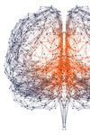 DATQUANT 2.0 STAND ALONE - SOFTWARE QUANTITATIVO PER L'IMAGING DAT-SPECT - GE HEALTHCARE
