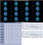 DATQUANT 2.0 STAND ALONE - SOFTWARE QUANTITATIVO PER L'IMAGING DAT-SPECT - GE HEALTHCARE
