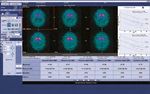 DATQUANT 2.0 STAND ALONE - SOFTWARE QUANTITATIVO PER L'IMAGING DAT-SPECT - GE HEALTHCARE