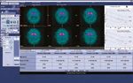 DATQUANT 2.0 STAND ALONE - SOFTWARE QUANTITATIVO PER L'IMAGING DAT-SPECT - GE HEALTHCARE