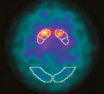 DATQUANT 2.0 STAND ALONE - SOFTWARE QUANTITATIVO PER L'IMAGING DAT-SPECT - GE HEALTHCARE