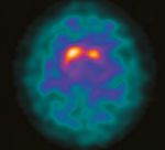 DATQUANT 2.0 STAND ALONE - SOFTWARE QUANTITATIVO PER L'IMAGING DAT-SPECT - GE HEALTHCARE