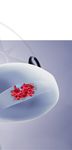 Cancro dell'endometrio - LINEE GUIDA - guidelines.esgo.org