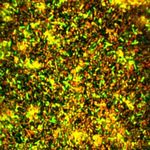 COLORAZIONE ED OSSERVAZIONE DEI MICRORGANISMI - GIOVANNI DI BONAVENTURA, PH.D. CI "MICROBIOLOGIA E MICROBIOLOGIA CLINICA" CDS MEDICINA E CHIRURGIA ...