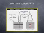 CATETERI VENOSI CVC-PICC-MIDLINE - Guida di rapida consultazione Indicazione - Classificazione Caratteristiche - Gestione