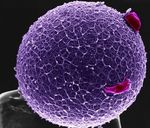 Procreazione assistita ed analisi genetica pre-impianto: ultime novit&agrave;