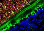 Gestione del paziente con Clostridium difficile in PS - F. Franceschi Fondazione Policlinico Universitario A. Gemelli, Universit&agrave; Cattolica, Roma ...