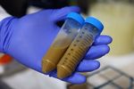 Gestione del paziente con Clostridium difficile in PS - F. Franceschi Fondazione Policlinico Universitario A. Gemelli, Universit&agrave; Cattolica, Roma ...