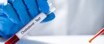 American College of Cardiology - ACC.20 World Congress of Cardiology PDF INTERATTIVO - Pharmastar