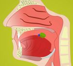 LA DISFAGIA - Moodle@Units