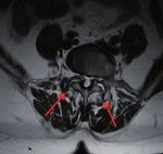 C3 CryoSystem Trattamento del dolore cronico - INTERVENTIONAL PERCUTANEOUS PAIN MANAGEMENT - Biomedica Italia Srl