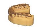 Professional DLP 3D printer - Stampante 3D DLP professionale Dental
