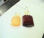 La scelta del donatore di sangue e la donazione - Elearning Dipartimento ...