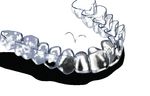 IL POTE- RE DEL TUO SORRISO - Gli allineatori invisibili per correggere le malposizioni dentarie - Biotech Dental
